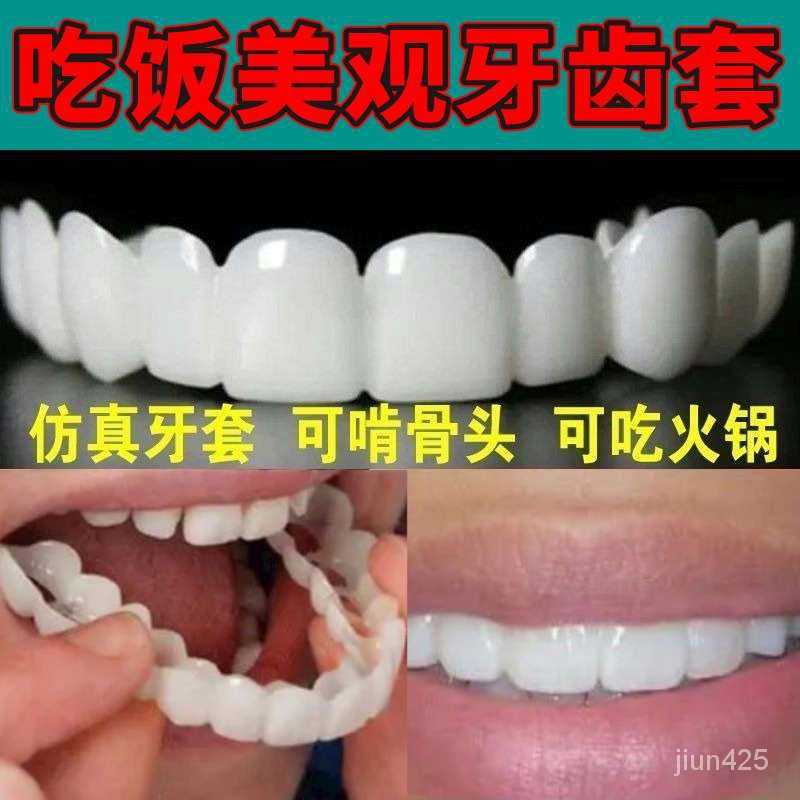 🔥全台灣最低價🔥萬能牙套喫飯神器老人通用補牙缺牙假牙自製無洞牙縫美白遮醜仿真