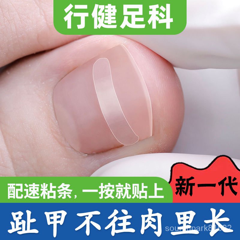 優選推薦德國行健足科腳指甲長裏拉拉正甲貼片甲溝嵌甲矯正器趾甲神器炎 DM1M