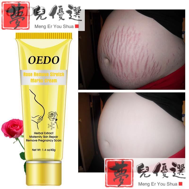 Rose Remove Stretch Marks Cream Anti Wrinkle Aging Maternity