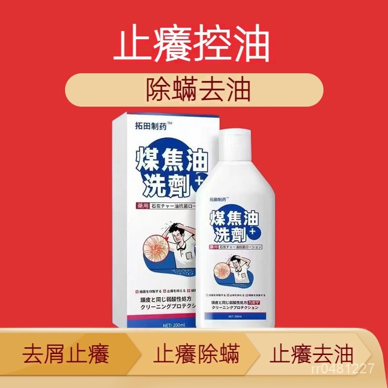 日本煤焦油洗劑 去屑止癢 除蟎 頭皮毛囊洗髮水 去油 控油 洗頭膏 正品