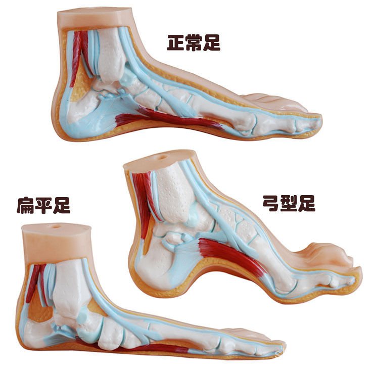 【佐模】可愛ins正常足、扁平足、弓形足模型 足弓模型 解剖模型 腳模型 敎學模型 1TI5