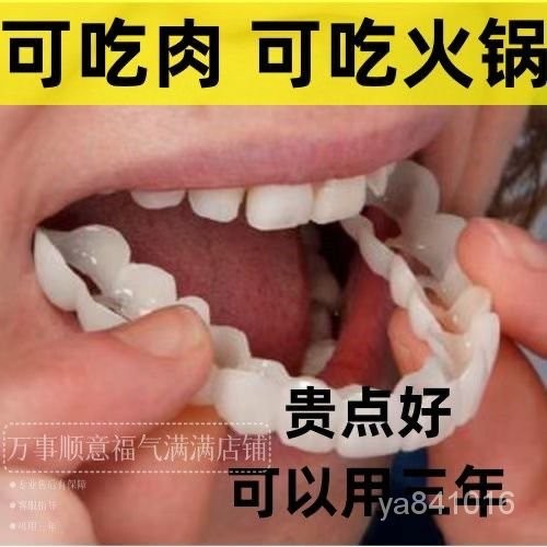 仿真牙套永久牙齒補缺牙喫飯神器老人通用補牙缺牙自製假牙套臨時