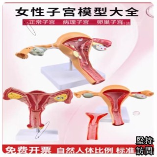 人體女性生殖子宮解剖病理模型 陰道卵巢教學模型 婦科生殖科教具