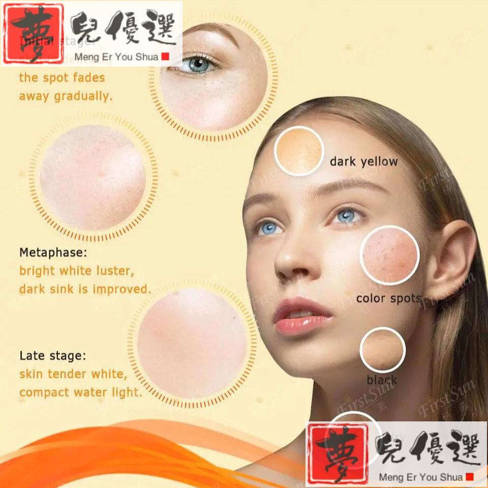 Anti Melanin Face Cream Remove Melasma Dark Spot Repair Skin