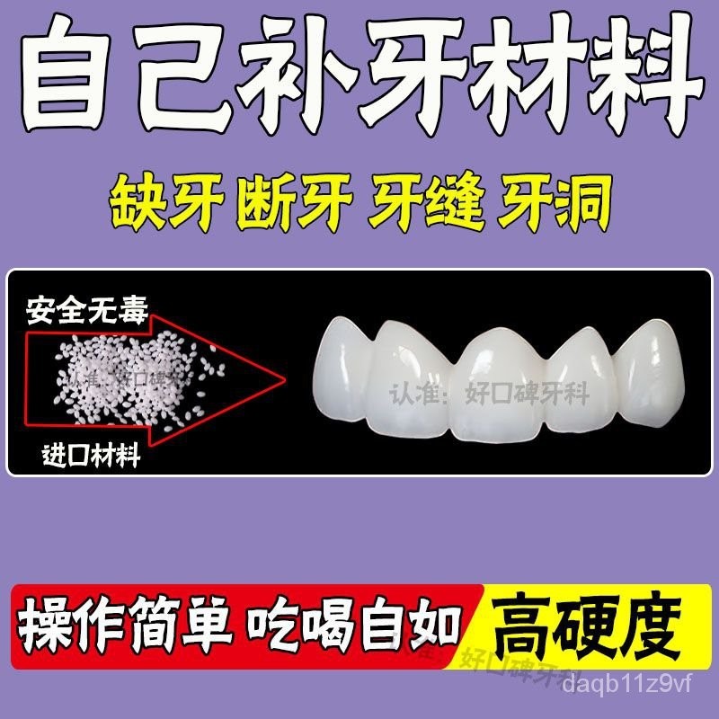 【桃園出貨】顆粒補牙神器補牙材料 永久自己動手牙齒補缺牙 臨時假牙 樹脂堵牙洞 臨時補牙材料 假牙材料 牙膠 假補牙洞斷