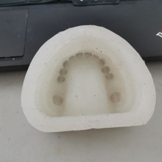 小百合模處理1缺失牙陰模 上頜6牙缺失模具 翻石膏牙模矽膠模具 第一磨牙模型展示模型