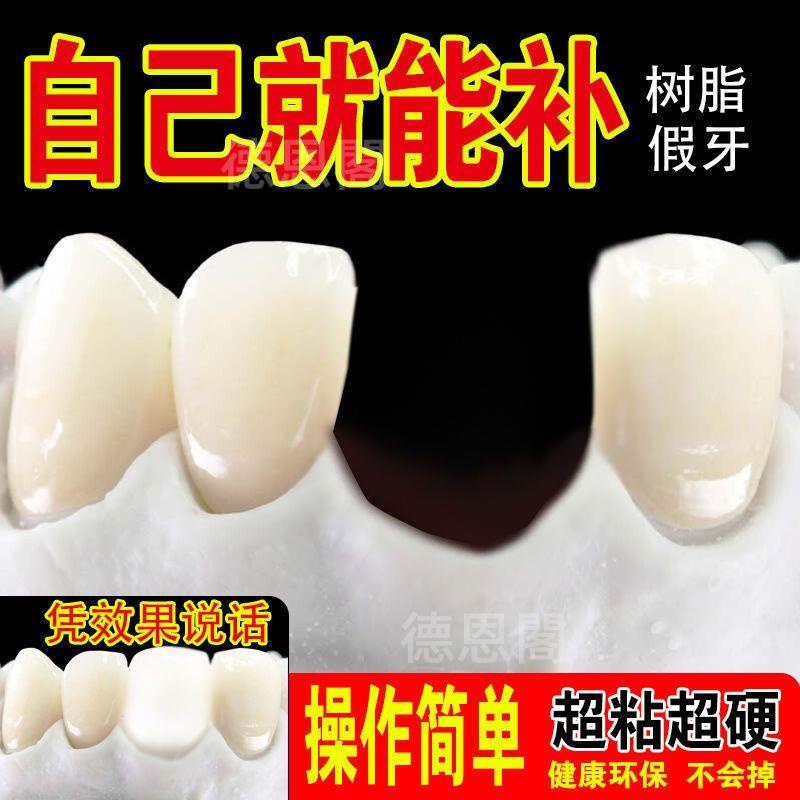 【優選精品】補牙神器臨時假牙補牙材料自制假牙材料牙縫仿真牙美觀遮蓋樹脂牙齒