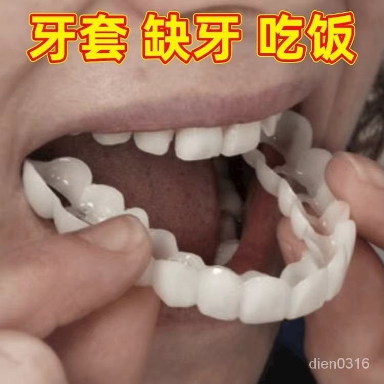 全台灣最低！正品仿真萬能牙套無孔無洞牙套牙齒美白假牙填充牙缺牙縫補牙通用