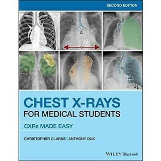 [華通書坊]Chest X-Rays for Medical Students 2/e 9781119504153