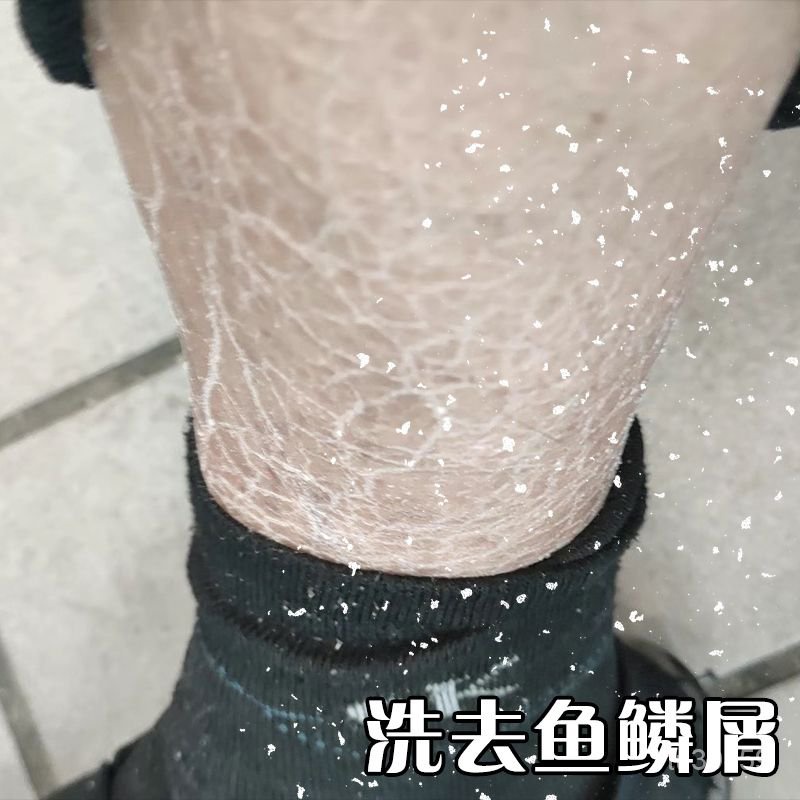 魚鱗皮沐浴露去雞皮美白保溼毛囊角化蛇皮膚乾燥腿脫皮起皮去角質 O3RU