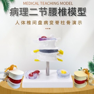 小百合模人體腰椎間盤演示模型腰椎模型脊柱模型脊椎模型關節模型醫學教學模型展示模型