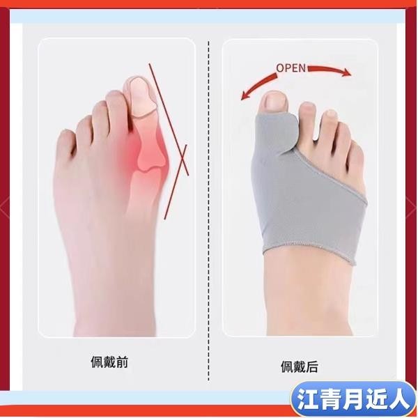 台灣出貨下殺價 糾正大腳骨突出腳趾矯正器分大母腳趾頭足男女士拇指外翻可以穿鞋