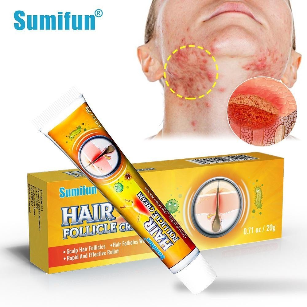 Sumifun毛囊炎 頭皮毛囊 長疙瘩 毛囊發紅 瘙癢 腫脹 頭皮屑 去屑 止癢 頭癬 抑菌