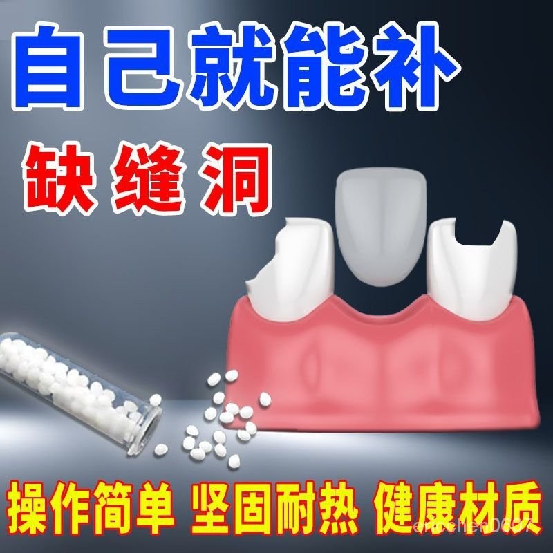【桃園出貨】補牙材料永久自己動手補牙樹脂膠永久高硬度填牙洞補牙縫神器用醫