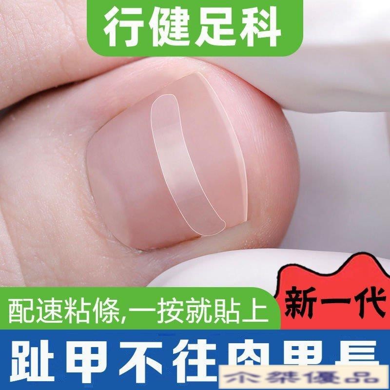 【尒桀優品 台灣現貨】行健足科 正甲貼片套裝 甲溝嵌矯正器 趾甲神器 捲甲矯正器 指甲矯正 凍甲貼片 腳指甲矯正器 OP