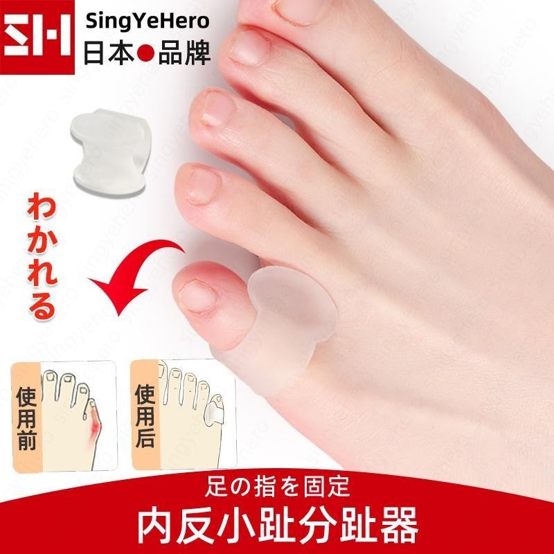 日本 小腳趾頭矯正器 小拇指內外翻矯正器 可穿鞋 重疊分趾器 防磨保護套 腳趾保護套 分趾器 腳趾矯正器