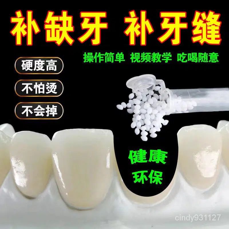 【落日吧】補牙材料自己在傢補牙假牙門牙可拆卸修補神器補牙縫掉牙齒補缺牙