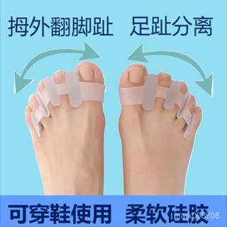 💥精品熱賣💥【可開票】拇指外翻腳趾矯正器 分趾器 大拇指外翻內翻大腳骨足外翻腳趾分指器【老趙精選】