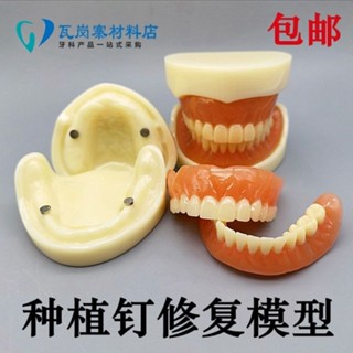 小百合模口腔模型 全口種植釘修復模型 假牙展示模型 齒科種植釘修復模型展示模型
