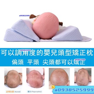 【廠傢直銷】頭部矯正器 嬰兒枕頭防偏頭定型枕 寶寶頭型枕 嬰兒矯正枕頭 嬰兒定型枕 嬰兒矯正枕頭 寶寶頭型矯正