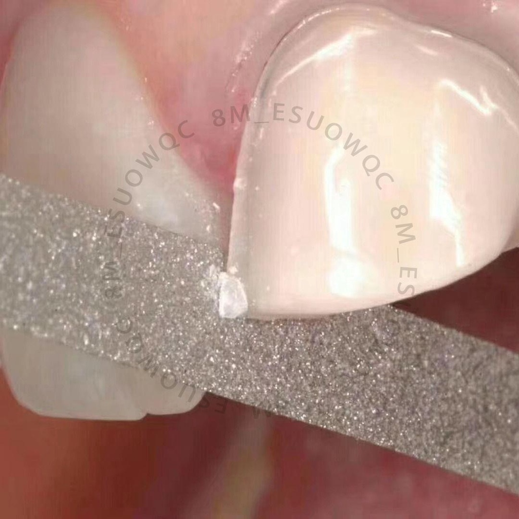 ［牙科材料商］磨牙條單面打磨條細砂條成人牙齒器開牙縫工具條打磨條1081