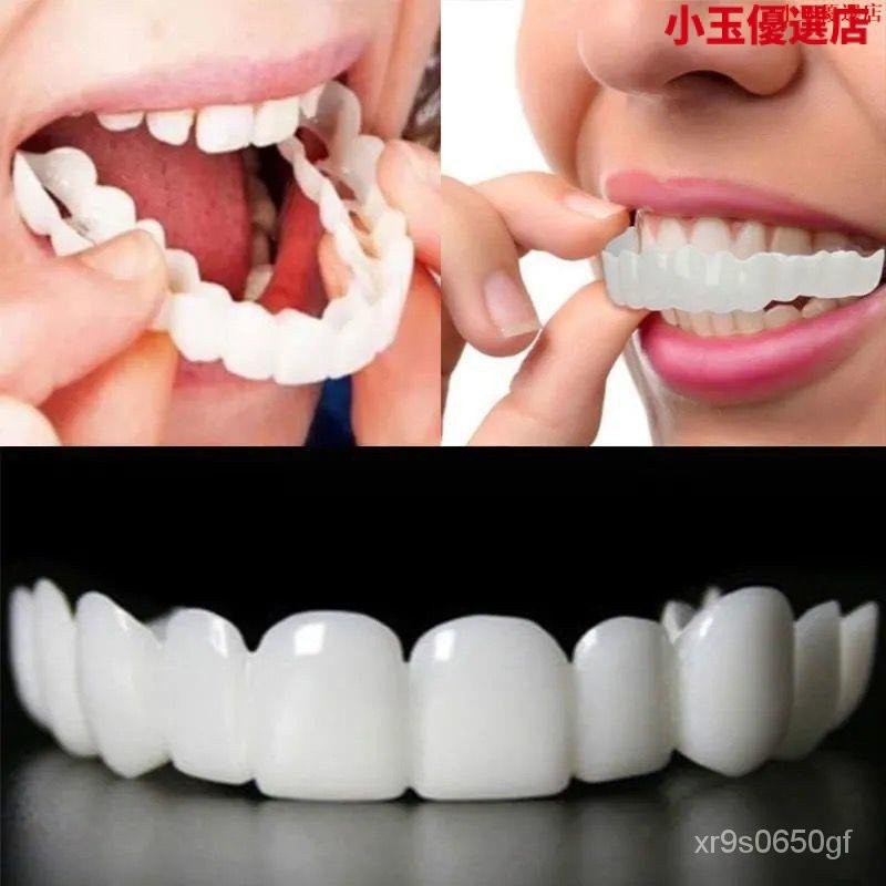 【台灣熱賣】49代仿真塑形牙套老人喫飯固齒假牙臨時缺牙填充牙縫補牙通用牙套