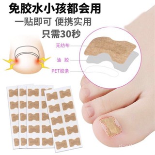 ✨桃園出貨✨甲溝炎矯正神器正甲貼腳趾甲專用矯正器貼片指甲長肉裡腳拉拉貼 正甲扣甲鉤紮肉墊片正甲指甲內長腳趾甲