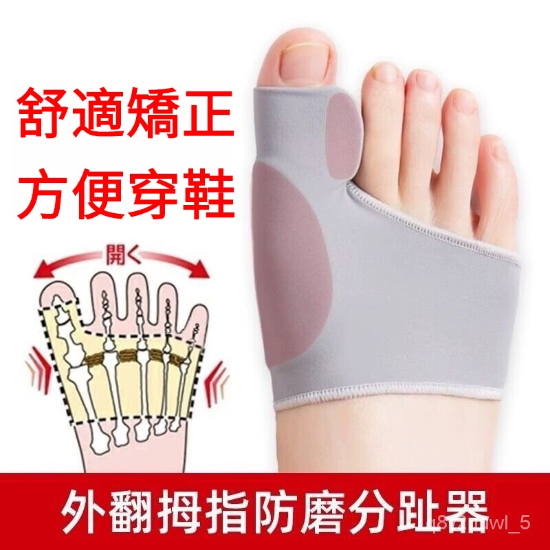 腳趾矯正器 分大母腳趾頭足 糾正大腳骨突出 可以穿鞋 男女士 拇指外翻