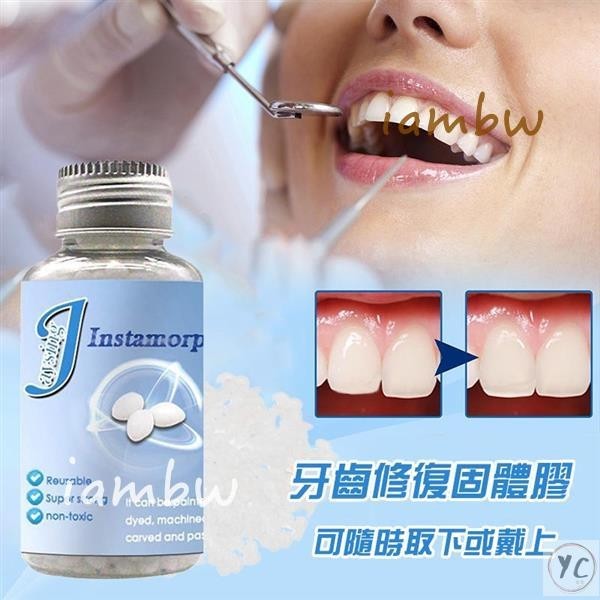 【熱銷】臨時假牙 補牙樹脂 補缺牙齒 自己補牙 縫義齒 牙套牙洞材料 假牙材料
