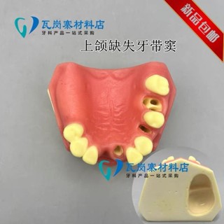 小百合模種植模型 半口種植模型 牙齒種植練習上頜竇 齒科耗材軟牙齦模型展示模型