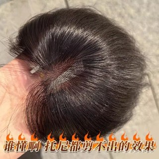 KEKE💗髮際綫假髮貼胎毛劉海假髮女片 頭頂自然前額補髮模擬髮 無痕高顱頂 透氣 逼真 新款 輕薄 修顔 無痕 增髮