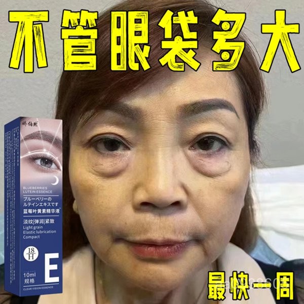 【艾米的賣場】【專祛大眼袋】眼霜去黑眼圈去眼袋去細紋緊緻抗皺熬夜眼霜精華液