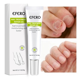 【Eelhoe指甲修護凝膠】Nail Repair Cream指甲修護指甲護理膏指甲凝膠20G