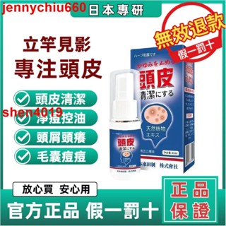 熱銷頭皮止癢液 頭皮淨化液頭皮屑頭皮毛囊炎噴劑 頭皮清潔頭皮保養抗頭皮屑敏感性頭皮止癢抑菌 頭皮調理液