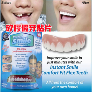 💖✨TV熱銷 lnstant smile 美白牙貼 矽膠假牙貼片 上排牙套 假牙套 美齒貼片 美白貼片 矽膠美齒貼