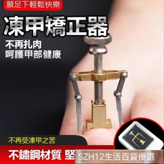 不鏽鋼凍甲矯正器 美甲腳趾卷甲 嵌甲矯正器 甲溝炎 糾正指甲 矯正器 指甲內陷糾正器 指甲矯正器