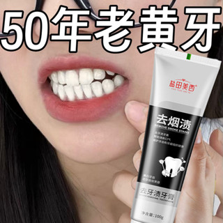 臺灣熱銷✨不用去洗牙 刷刷白瞭 快速美白 美白薄荷味亮白去漬去黃煙漬牙膏 牙膏 去牙石 去牙黃 牙漬 口腔護理