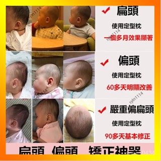 🌺花開🌺🌺嬰兒枕頭 定型枕 新生兒枕 嬰兒定型枕 嬰兒枕頭 防扁頭 頭型枕 兒童枕 寶寶枕頭 頭型枕 立體-QAS