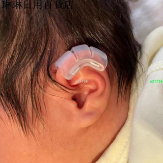 免運🚀🚀新生兒耳朵矯正器耳朵矯正器嬰兒貼耳廓貼糾正塑形耳輪定型牽引器6.25