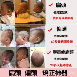 🌺嬰兒枕頭 定型枕 新生兒枕 嬰兒定型枕 嬰兒枕頭 防扁頭 頭型枕 兒童枕 寶寶枕頭 頭型枕 立體枕嬰兒枕頭 防偏頭定型