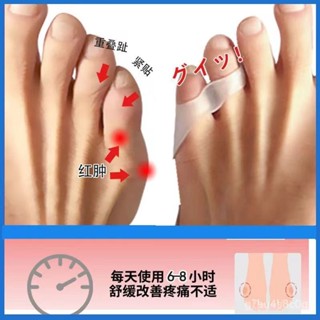 【戀戀的賣場】小腳趾內翻矯正器腳骨重疊分趾器小拇指外翻保護套男女士可穿鞋