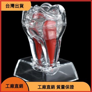 &臺灣發貨&牙齒模型 透明雙層可拆分牙模型 齒模型 禮品模型
