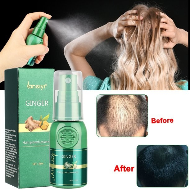 Spray Serum Hair Tonic Jahe Penumbuh dan Menebalkan Rambut