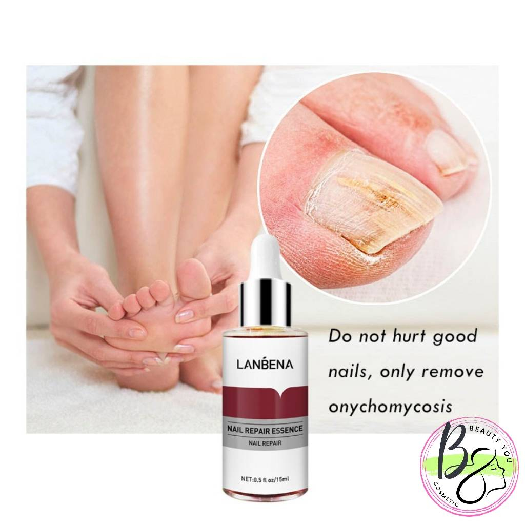 LANBENA nail repair essence serum kuku lanbena /jamur kuku