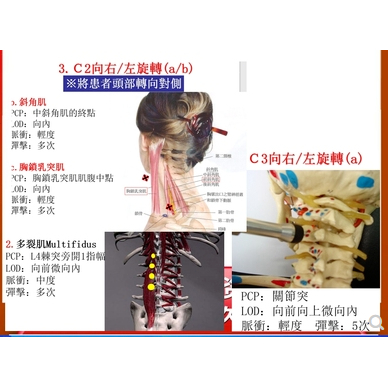 【G|mai|發送】素材資料C---美式整脊槍脊椎矯正器正骨診斷解剖使用方法技巧資料課件培訓PPT