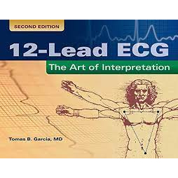 12-Lead ECG The Art of Interpretation. 2/e