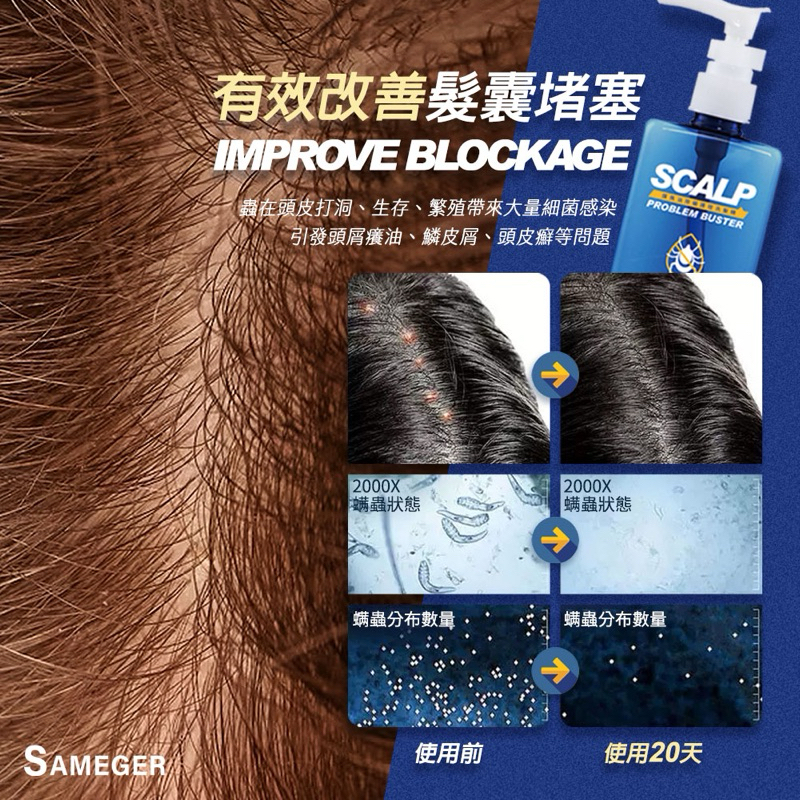 SAMEGER-煤焦油除蟎護理洗髮精