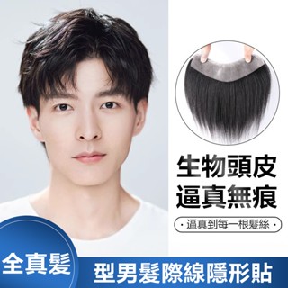 真髮 髮際線 假髮貼 男士前額補髮 禿頂假髮片 透氣假髮 M型額頭劉海片 自然假髮 男士高額頭 增加髮量 隱形髮片 假髮