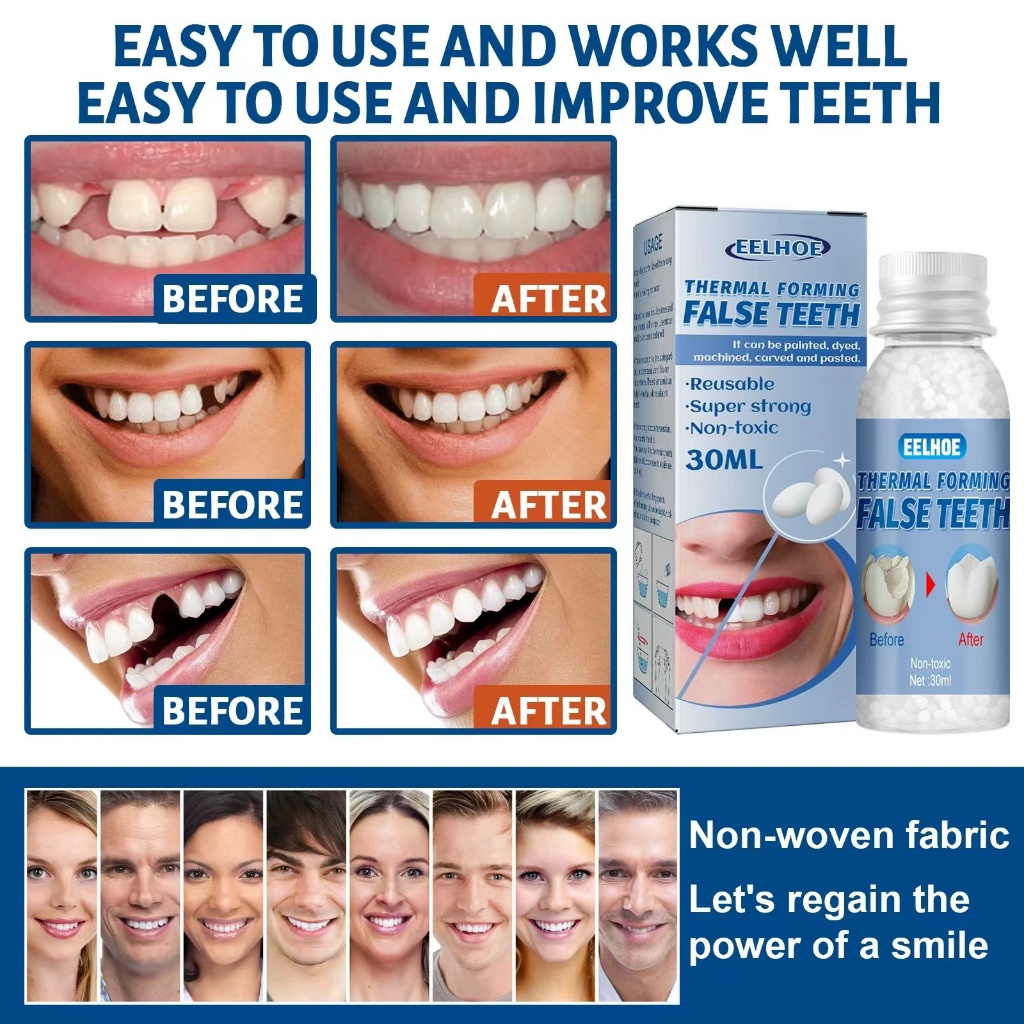 【台灣熱賣】EELHOE 可塑性牙膠 影視化妝假牙修飾臨時補牙牙膠牙洞牙縫