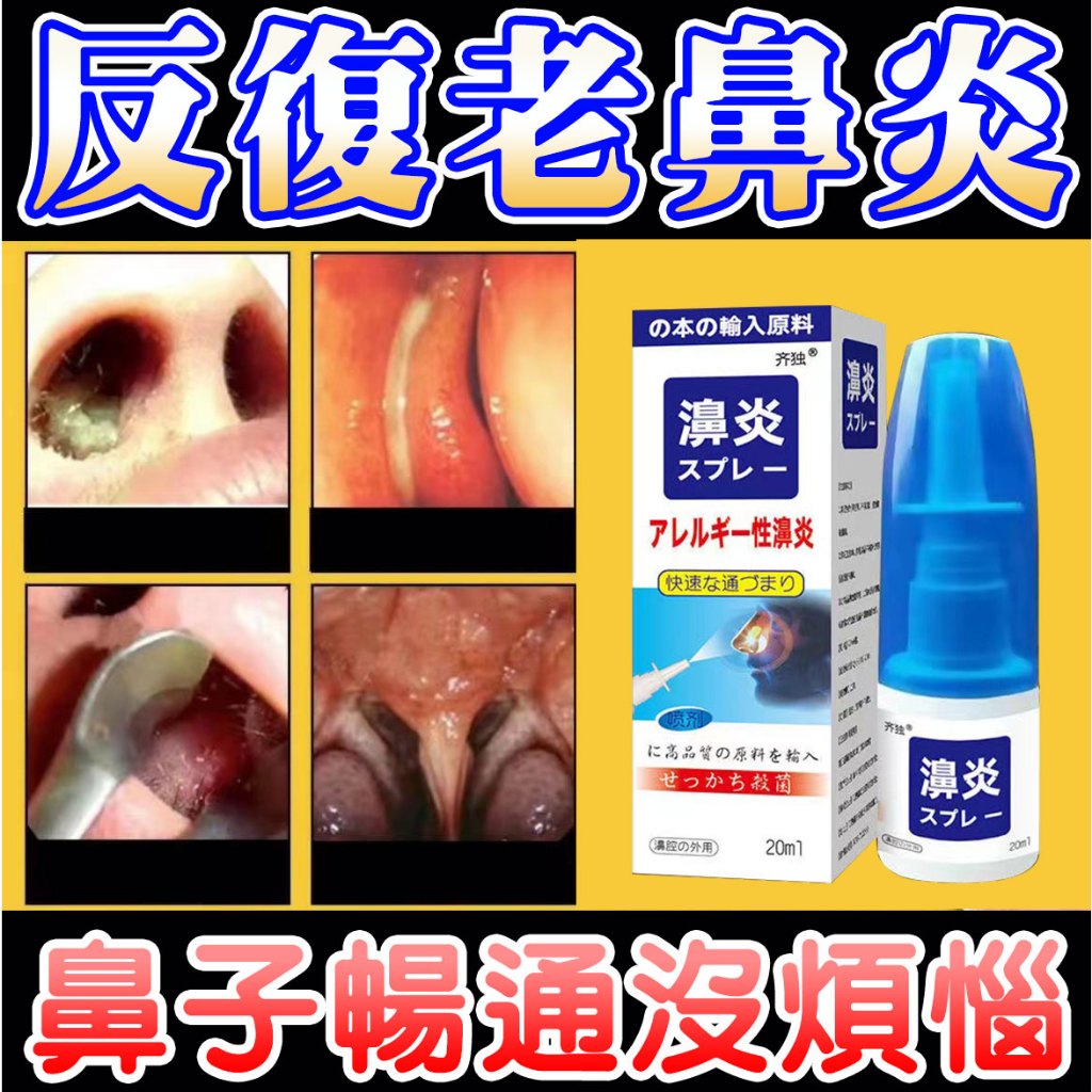 【鼻塞一點通】鼻舒眠噴劑鼻炎噴劑鼻通凝膠鼻塞貼片鼻子過敏噴霧鼻塞精油鼻癢止癢液過敏性鼻炎歐治鼻噴劑鼻爽貼鼻通噴霧